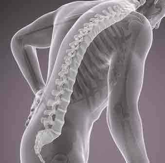 Osteoporosis-in-tamil, home remedy bone loss